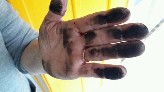 Mão suja pela fuligem, resultado das queimas da coqueria de Rio Carvão / Divulgação