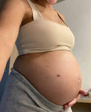 Notícia - Amor além do útero: casal luta pela vida da filha ainda no ventre da mãe