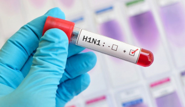 Notícia - Região registra primeira morte por H1N1 em 2018