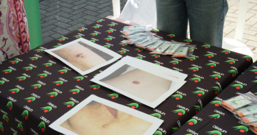 Notícia - Protetor na mão: campanha contra câncer de pele movimenta o Centro