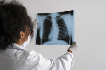 Notícia - Programa da Vigilância em Saúde de Criciúma atua prevenção e tratamento da Tuberculose
