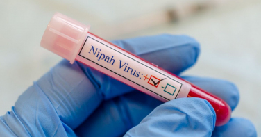 Notícia - Vírus Nipah: doença já matou mais de 200 pessoas na Ásia; entenda