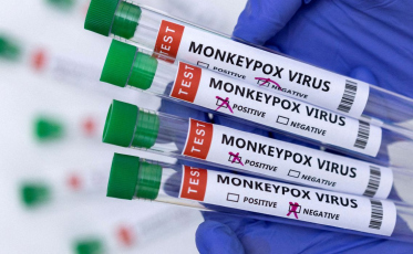 Em uma semana, casos confirmados de Monkeypox aumentaram quase 40% em SC