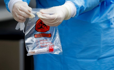 Estado tem 52,5 mil casos e 662 mortes por Covid-19