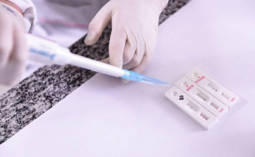 Estado tem 87,9 mil casos de Covid-19