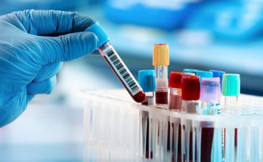 Unimed realiza testes rápidos a R$ 250 em Criciúma