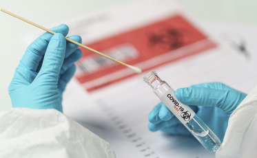 Estado registra mais 16 óbitos por Covid-19