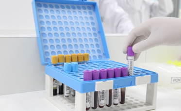 Covid-19: Qual o melhor teste? E o melhor momento para fazer?