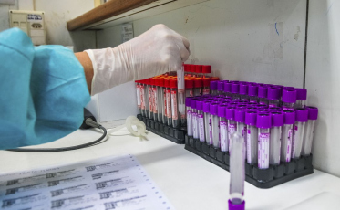 Estado registra mais 3,2 mil casos de Covid-19 nesta quarta-feira