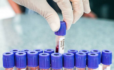 Covid-19: Mais 1,7 mil casos em Santa Catarina