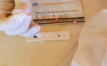 Estado doa 4 mil testes rápidos para o Saúde na Estrada