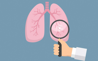 Tuberculose na Ucrânia: o problema do terceiro exército