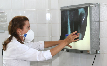 Brasil registra 78 mil novos casos de tuberculose