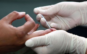 Criciúma evolui na luta contra a AIDS