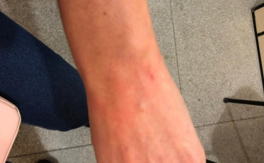 Servidora diz ter sofrido agressão em prefeitura