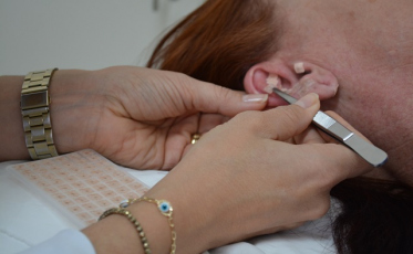 Mais de 300 atendimentos de auriculoterapia em Morro da Fumaça