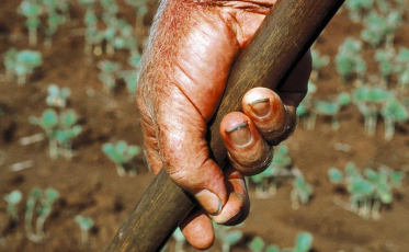 Chapéu e protetor solar ajudam os grupos de risco a evitar o câncer de pele