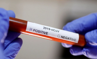 Covid-19: SC registra 482 novos casos e 18 mortes