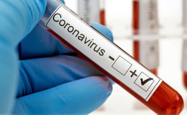 Covid-19: SC registra 712 novos casos e 17 mortes 