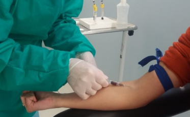 Urussanga registra primeiro caso presumível de reinfecção pelo coronavírus