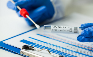 Estado perto dos 499 mil casos de Covid-19