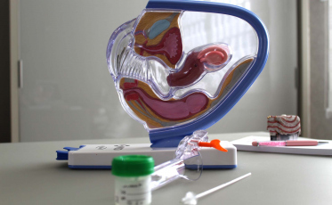 Preventivo é fundamental para detectar o câncer do colo do útero