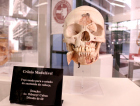 Museu da Odontologia de SC realiza exposição na Unesc