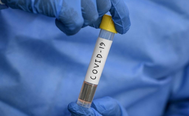 Taxa de letalidade segue em 1,61% no estado