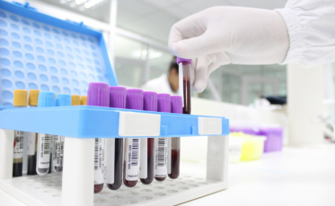 Empresas adquirem testes rápidos de Covid-19 para monitorar colaboradores