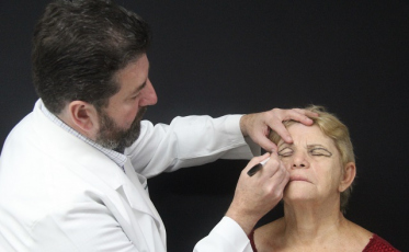 Clínica recebe idosos para cirurgias de blefaroplastia