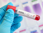 Região registra primeira morte por H1N1 em 2018