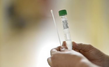 Manutenção dos protocolos são fundamentais para conter variante Delta, aponta especialista