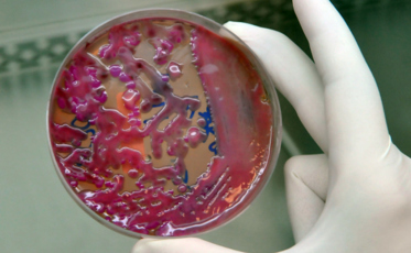 Superbactéria resistente a antibióticos restringe UTI Neonatal de hospital em SC