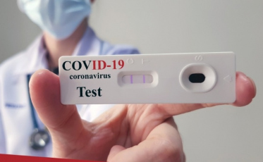 Covid-19: Arroio do Silva terá testes para população em geral