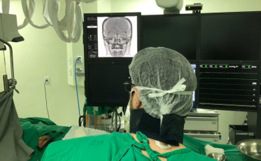 Tratamento inédito de AVC é realizado no Hospital São José