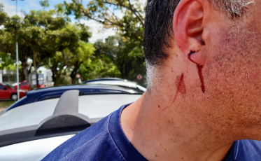 Motorista de aplicativo é ferido em tentativa de assalto 