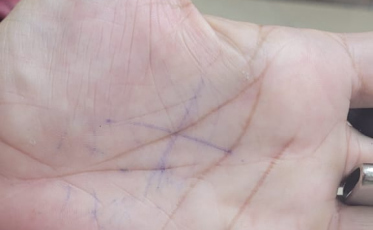 Mulher faz X na palma da mão e companheiro é preso em flagrante em Criciúma