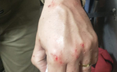 Policial é agredido durante abordagem em Criciúma 