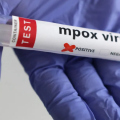 Porto Alegre registra primeiro caso de Mpox em 2026; OMS confirma nova cepa em 2 países
