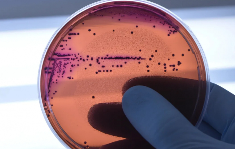 KPC: superbactéria resistente identificada em hospital de Criciúma pode causar infecções graves