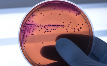 KPC: superbactéria resistente identificada em hospital de Criciúma pode causar infecções graves
