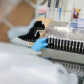 Vacina 100% brasileira contra a malária avança e terá primeiros testes em humanos