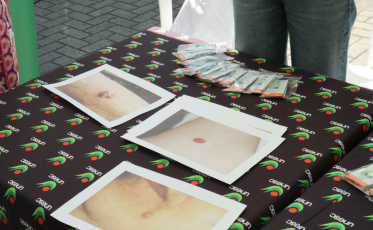 Protetor na mão: campanha contra câncer de pele movimenta o Centro