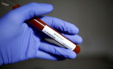 Quatro mortes por Covid-19 no Sul do estado