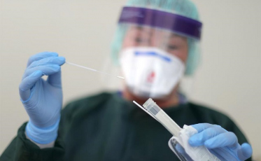 Coopera doa 3 mil testes de Covid-19 para prefeituras da área de abrangência 