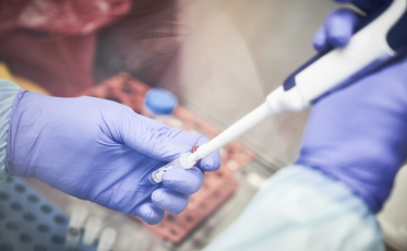 Mulher de 27 anos é diagnosticada com Covid-19 em Forquilhinha