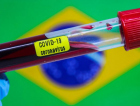 Covid-19: Brasil tem 18.8 mil óbitos