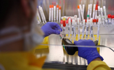 Estado confirma 27,2 mil casos e 347 mortes por Covid-19