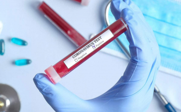 Estado tem nove mortes  por Covid-19 em 24h