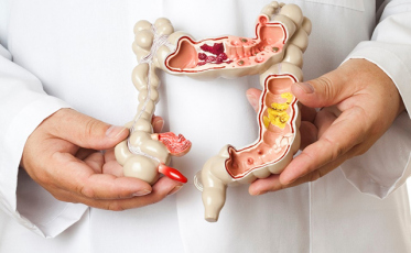 Campanha alerta para necessidade de prevenção do câncer de intestino